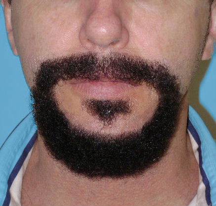 Costume Accessory Moustache & Beard Round Black Marco Deluxe
