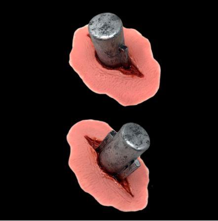 Prosthetics Tinsley Black Label Monster Bolts Deluxe