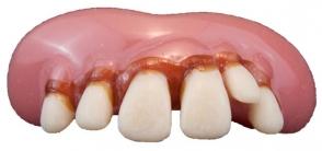 Teeth Billy Bob Big Cletus - Discontinued Line Last Chance To Buy