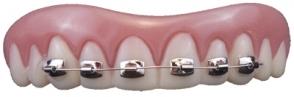 Teeth Biilly Bob With Braces