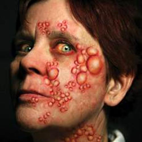 Temporary Tattoos Fx Diseased Plague Trauma Kit Pk/12 Pieces Tinsley Brand